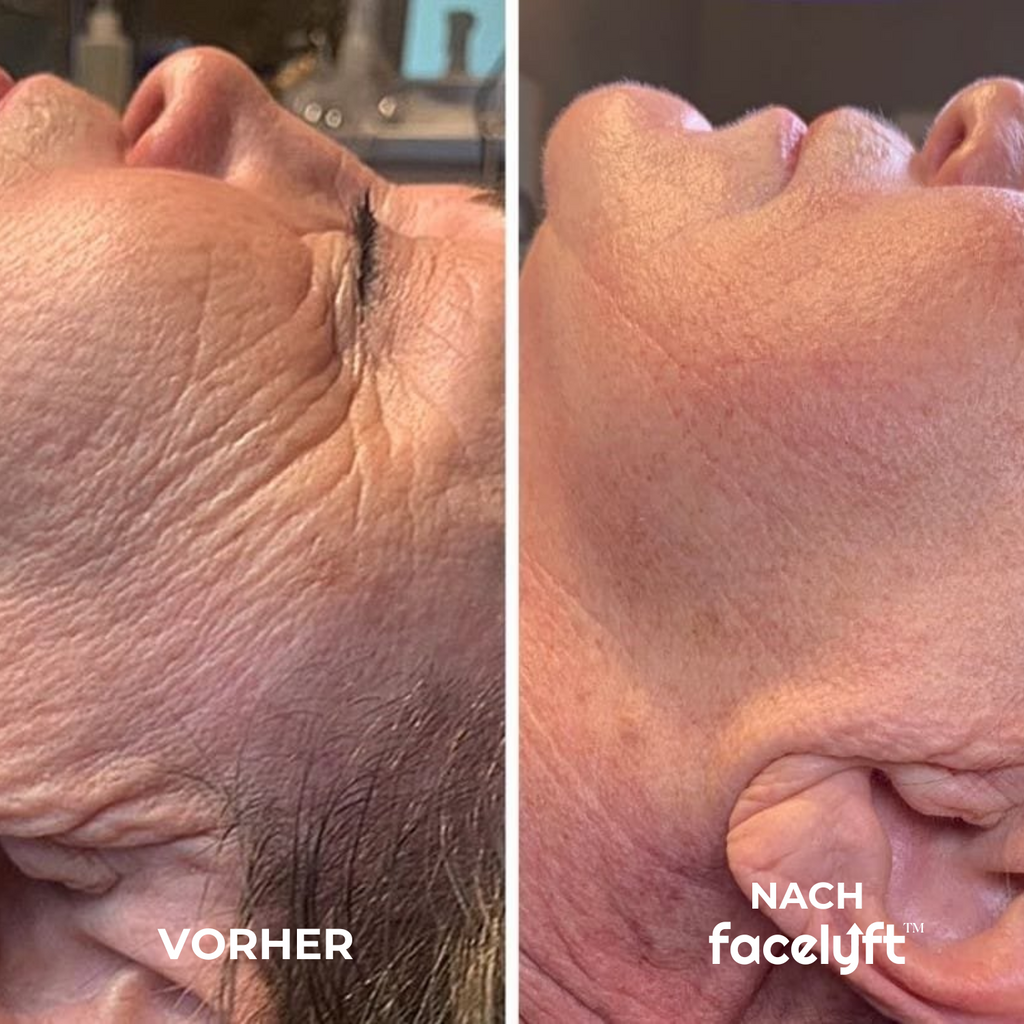 The Ritual | Sofort Lifting