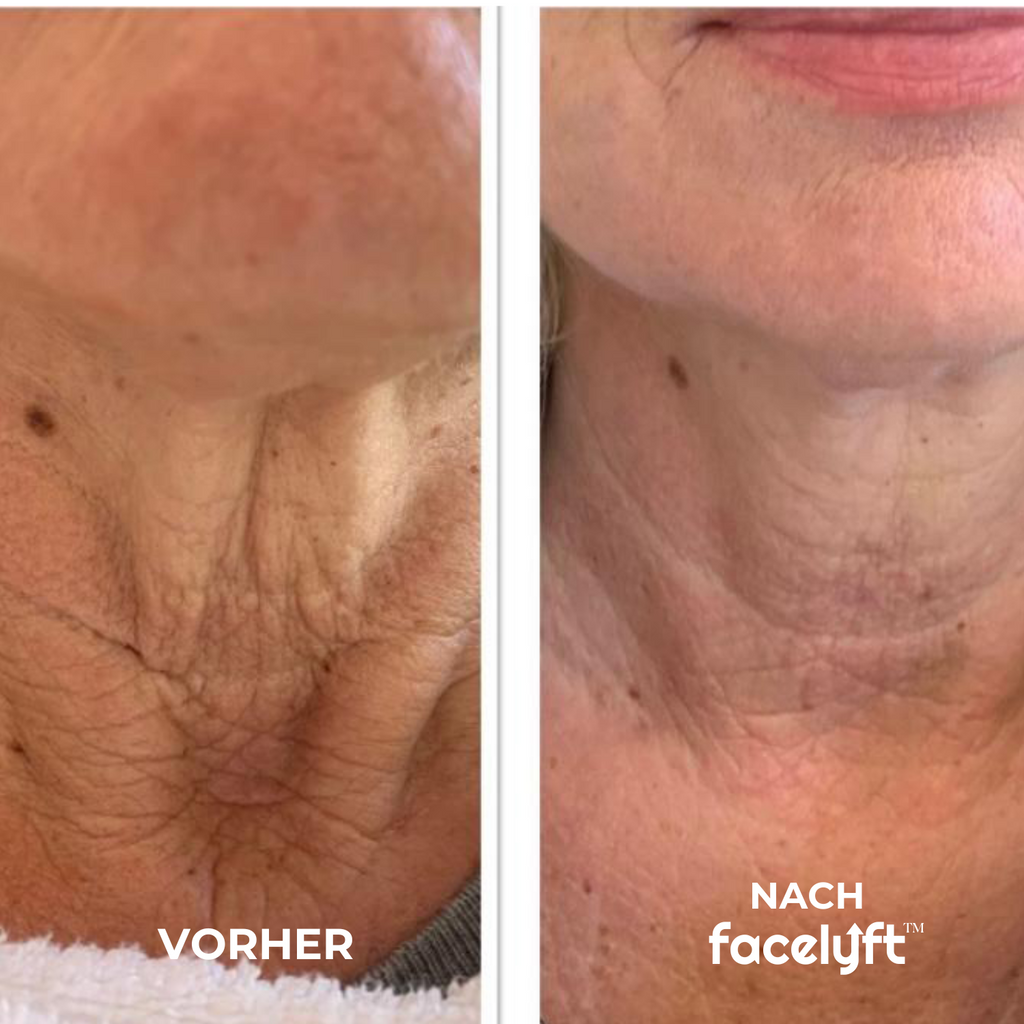 The Ritual | Sofort Lifting